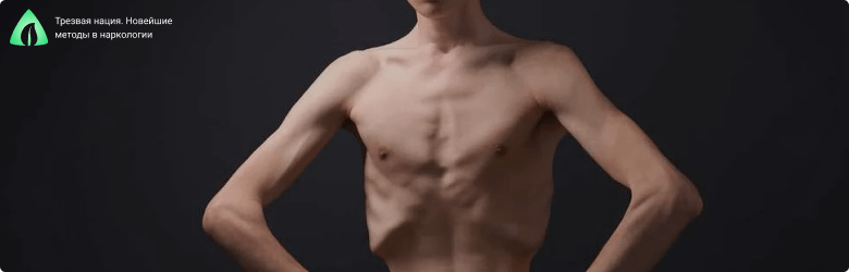 Анорексийный парень